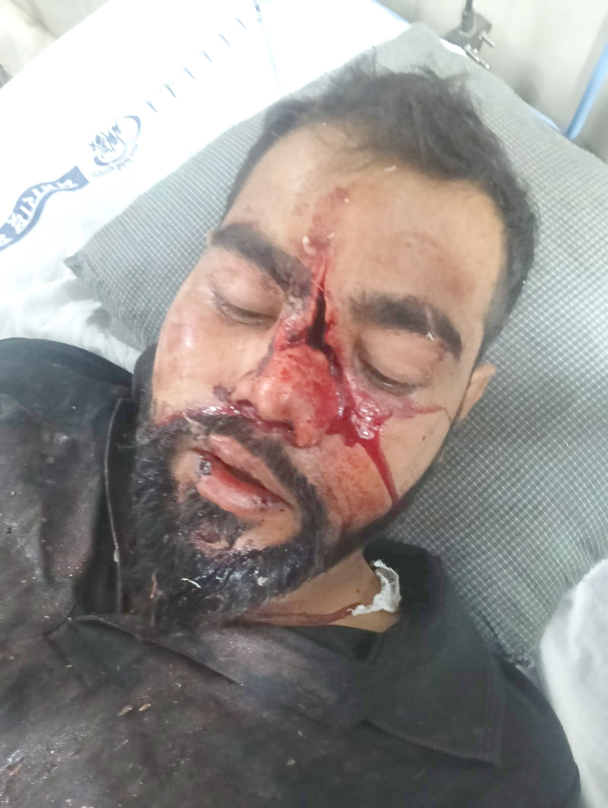 بیف ٹرانسپورٹیشن کے شبہ میں مسلم نوجوان پر حملہ حدگاؤں میں گورکشکوں نے نداف کی پٹائی کردی